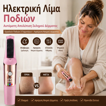 Ηλεκτρική λίμα ποδιών, αυτόματο τρίψιμο ποδιών, αφαίρεση κάλων, εργαλείο πεντικιούρ, τριτάχυτη ισχύς για την αφαίρεση νεκρού δέρματος.