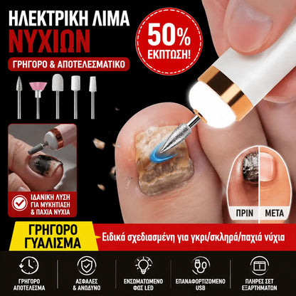 🦶🦶 Ηλεκτρική λίμα νυχιών για μύκητες νυχιών ποδιών, μια μικρή ηλεκτρική λίμα νυχιών.
