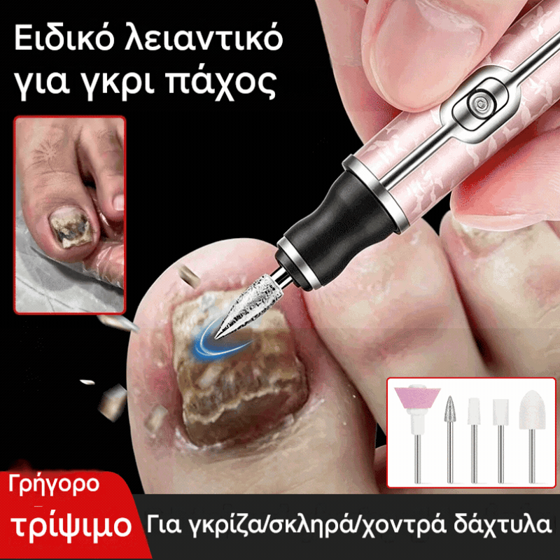 💅👍 Ηλεκτρική λίμα νυχιών για την αντιμετώπιση της ονυχομυκητίασης (μύκητας των νυχιών)